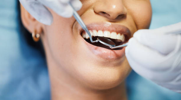 Best Emergency Treatment for Toothache in Lawrence, IN