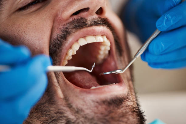 Best Emergency Treatment for Toothache in Lawrence, IN